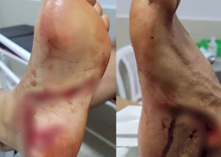 TURISTA É MORDIDA POR PEIXE DA ESPÉCIE DOURADO EM BALNEÁRIO DE BONITO