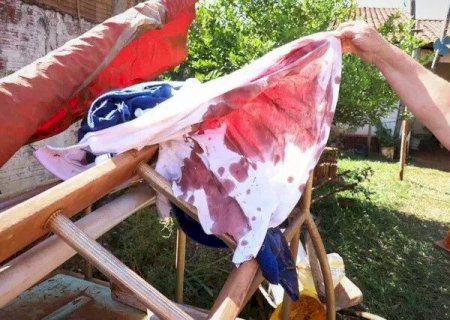 JOVEM BALEADO NO QUINTAL DE CASA PERDE BAÇO E PASSA POR CIRURGIA