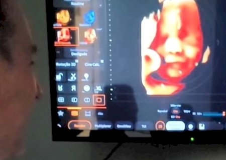 BEBÊ RESPONDE À VOZ DO PAI DA BARRIGA DA MÃE