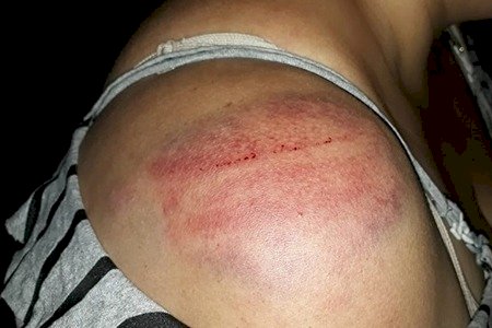 FLAGRADO COM OUTRA MULHER, HOMEM AGRIDE ESPOSA COM GOLPES DE BAMBU E CORRENTE