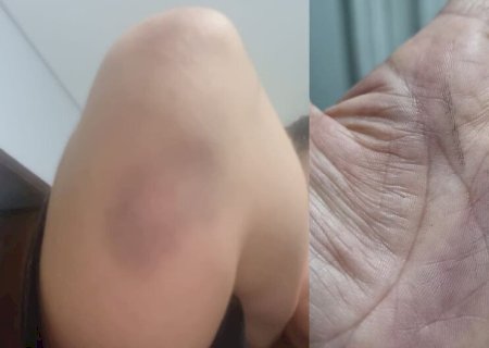 ESPANCADA E AMEAÇADA DE MORTE, MULHER PEDE AJUDA PARA NÃO SER A PRÓXIMA VÍTIMA