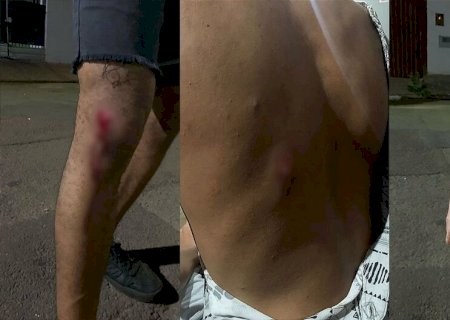 JOVENS SÃO ESPANCADOS POR DUPLA E RELATAM HOMOFOBIA: 'PARECIAM ANIMAIS'