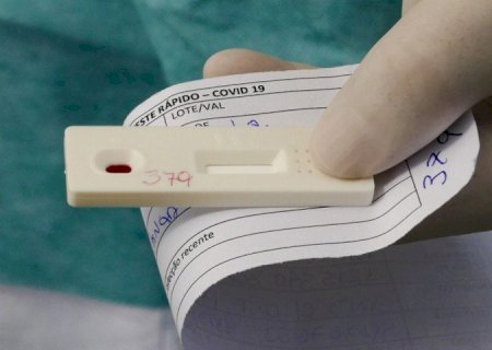 MS REGISTRA 20 MORTES POR COVID-19 EM 2025, QUEDA DE 41% EM RELAÇÃO AO ANO ANTERIOR