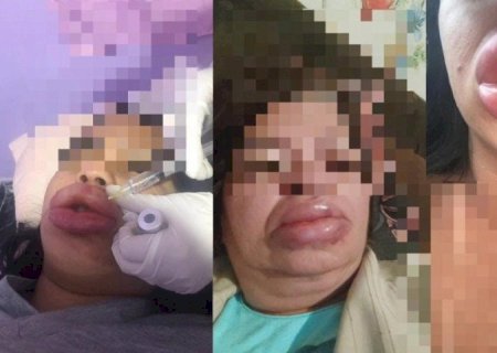 POLÍCIA INDICIA FALSA BIOMÉDICA POR 4 CRIMES NA CAPITAL