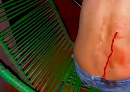 MULHER É ESFAQUEADA POR VIZINHA APÓS DESENTENDIMENTOS