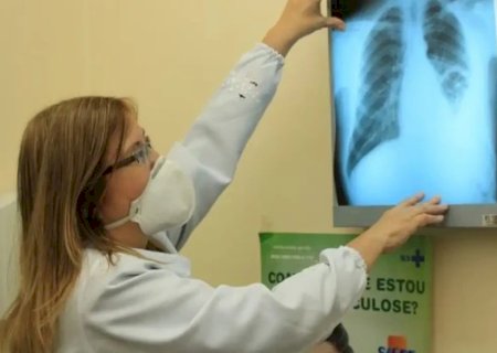 COM 192 CASOS EM 2024, DOURADOS INTENSIFICA AÇÕES PARA COMBATER TUBERCULOSE