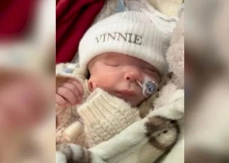 BEBÊ COM SÍNDROME NASCE SEM OLHO E COM ORELHA NA BOCHECHA