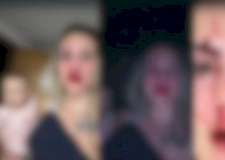 MÚSICO QUEBRA NARIZ DE JORNALISTA QUE ESTAVA COM BEBÊ NO COLO E MESMO ASSIM É SOLTO PELA JUSTIÇA