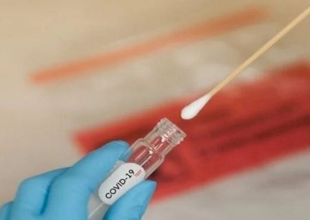 COM VÍTIMAS EM DOURADOS E DUAS CIDADES, NÚMERO DE MORTES POR COVID CHEGA A 28 NO ANO EM MS