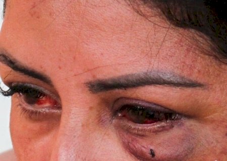 MS REGISTRA UMA OCORRÊNCIA DE VIOLÊNCIA DOMÉSTICA CONTRA MULHERES A CADA 25 MINUTOS