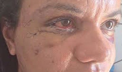 ALÉM DO SILÊNCIO: POR QUE A LUTA CONTRA A VIOLÊNCIA DE GÊNERO AGORA CONVOCA OS HOMENS AO PROTAGONISMO