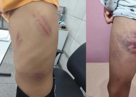 MENINO AUTISTA É SURRADO DENTRO E FORA DA ESCOLA E CONSELHO TUTELAR DENUNCIA OMISSÃOMENINO AUTISTA É SURRADO DENTRO E FORA DA ESCOLA E CONSELHO TUTELAR DENUNCIA OMISSÃO