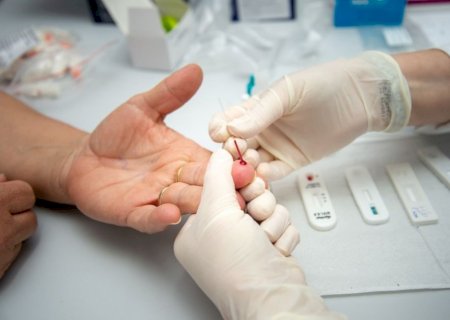 PREFEITURA REALIZA MAIS DE 2 MIL TESTES E NÃO REGISTRA NOVOS CASOS DE HEPATITE B EM 2026